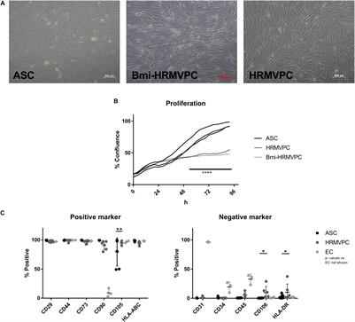 Pro-angiogenic Activity Discriminates Human Adipose-Derived Stromal Cells From Retinal Pericytes: Considerations for Cell-Based Therapy of Diabetic Retinopathy